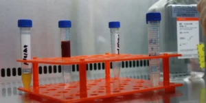 Immunochromatography